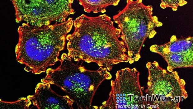 Καρκίνος: Η μεσογειακή διατροφή βοηθά στη θεραπεία του μελανώματος