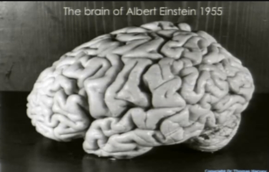 আইনস্টাইনের মস্তিষ্ক - Η τραγική ιστορία για το πώς κλάπηκε ο εγκέφαλος του Αϊνστάιν