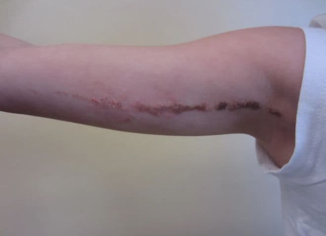 xeri - Όλοι έχουμε ρίγες σαν τις ζέβρες και δεν το ξέρουμε