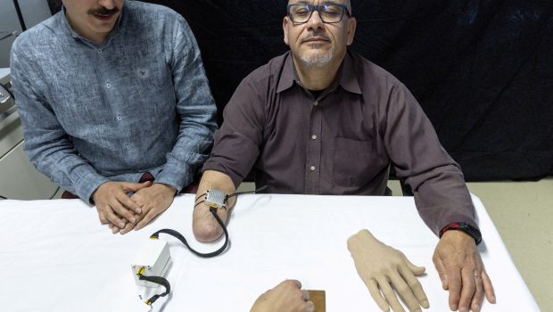 Βιονικό προσθετικό χέρι νιώθει τη ζεστασιά της ανθρώπινης επαφής