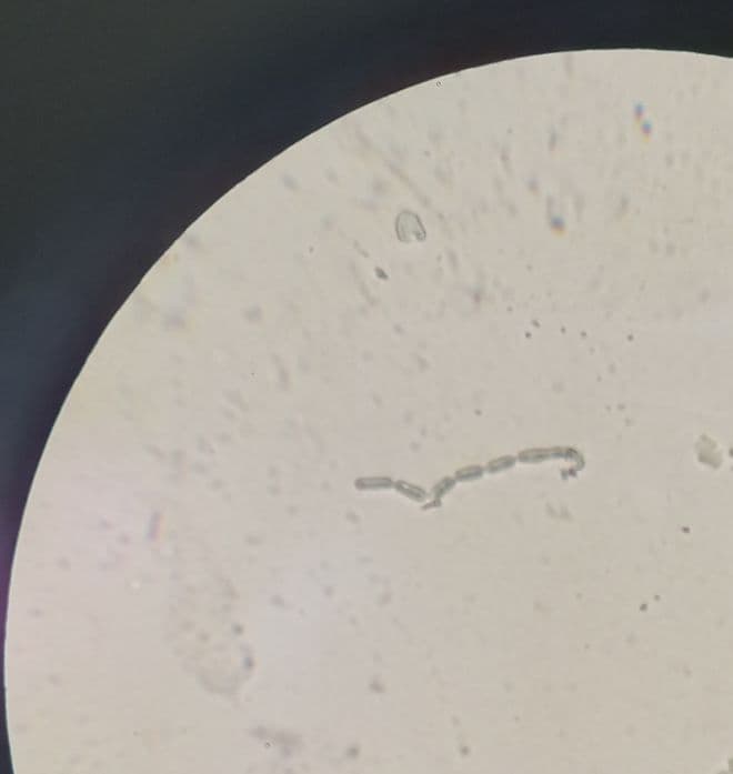 Bacterium_microscopy: Το υπερθερμόφιλο βακτήριο του γένους Bacillus που απομονώθηκε από το υποθαλάσσιο ηφαίστειο Κολούμπο (φωτογραφία μικροσκοπίου)