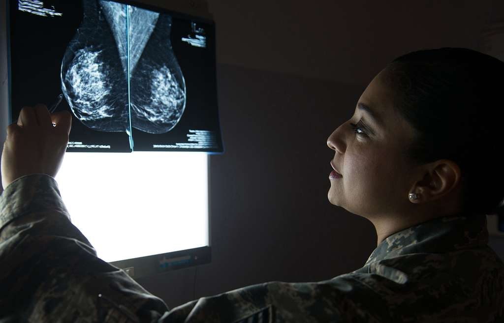 Γιγάντιο άλμα κατά του καρκίνου του μαστού