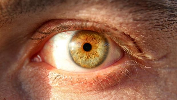 Γονιδιακή θεραπεία σε κολλύριο θεράπευσε τυφλό αγόρι