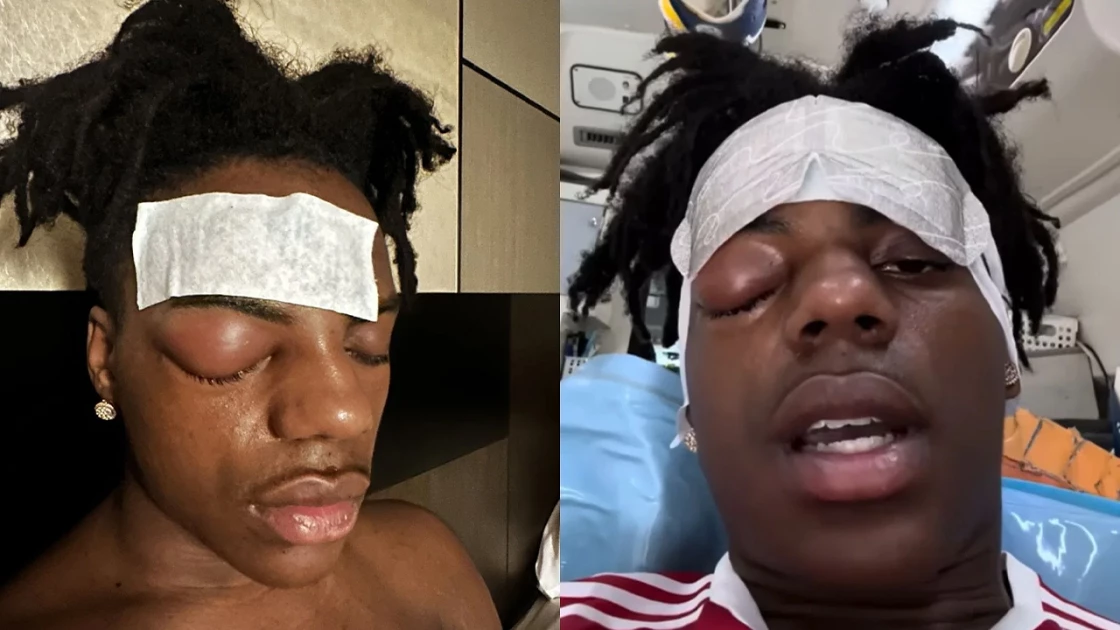 Εκτάκτως στο νοσοκομείο ο πασίγνωστος streamer IShowSpeed (ΒΙΝΤΕΟ)