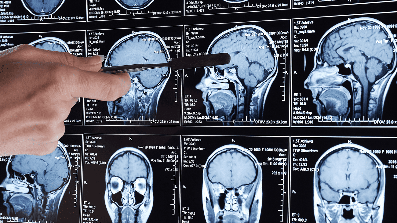 A doctor points to multiple MRI