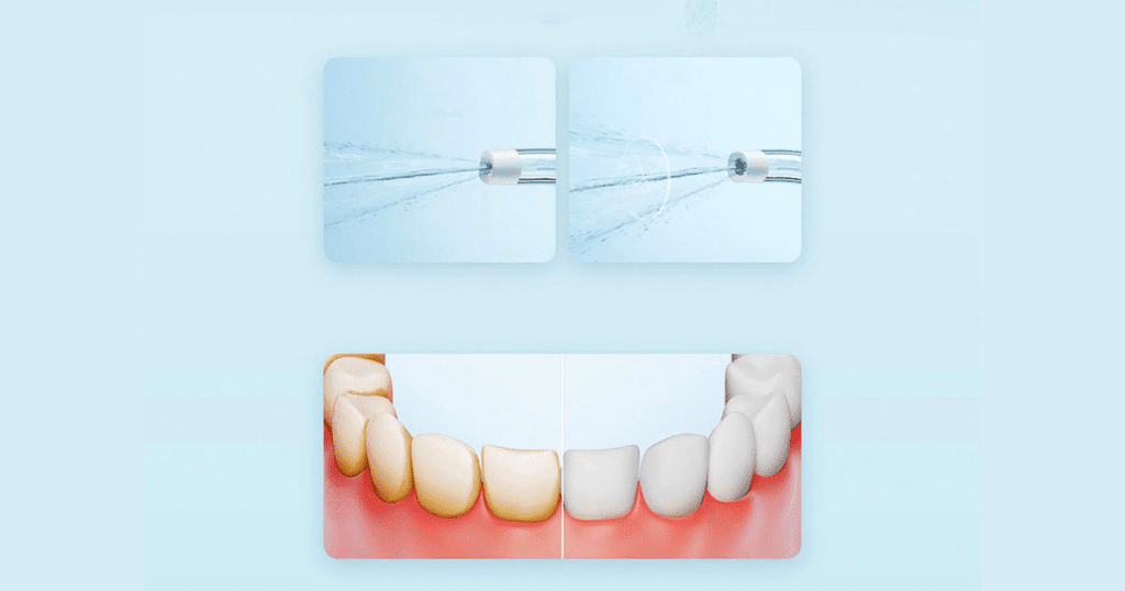 , Χαμηλότερη τιμή μέσω εκπτώσεων: Το βελτιωμένο στοματικό ντους Xiaomi Mijia Portable Oral Irrigator F300 θα φροντίσει για πιο τέλεια στοματική υγιεινή, TechWar.gr