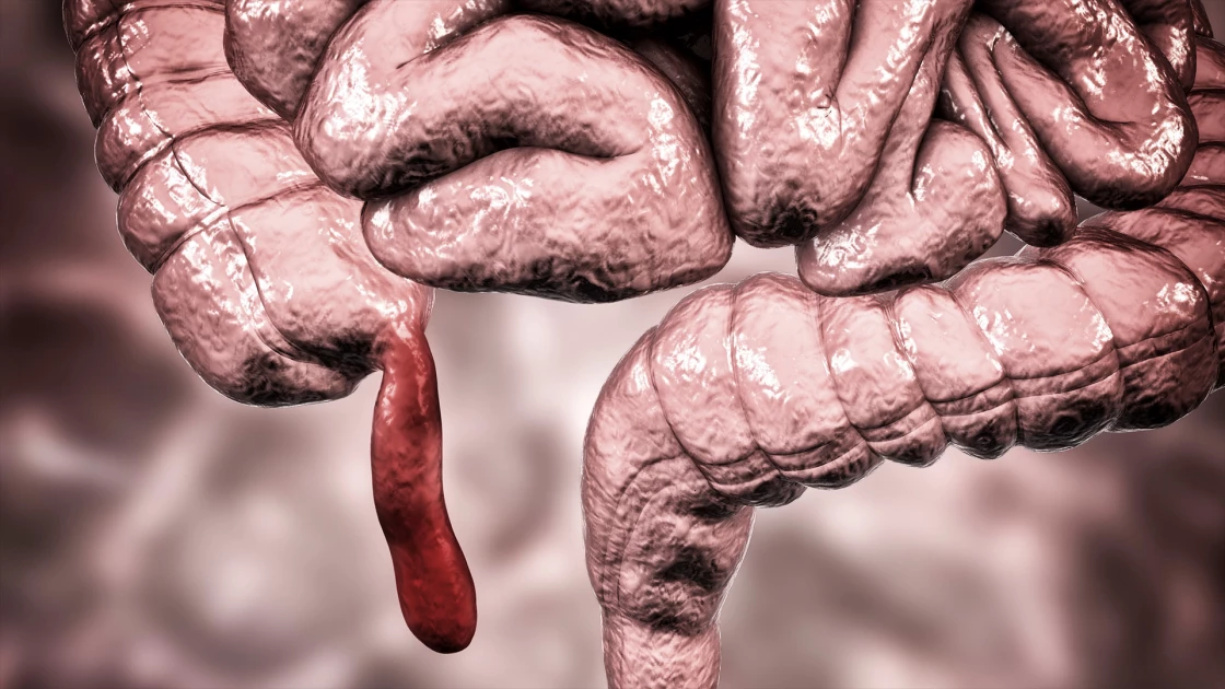 Γιατί οι γιατροί πρέπει να αφαιρούν τη σκωληκοειδή απόφυση πριν φύγουν για Ανταρκτική;