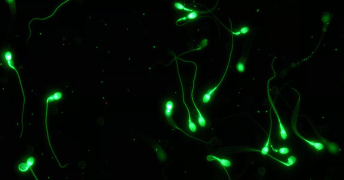 Η ποσότητα σπέρματος φαίνεται ότι επηρεάζεται από την χρήση του κινητού τηλεφώνου