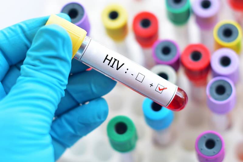 HIV: Στόχος η μείωση των μολύνσεων κατά 58% - Προληπτική αγωγή μετά από 7 χρόνια αναμονής, HIV: Στόχος η μείωση των μολύνσεων κατά 58% – Προληπτική αγωγή μετά από 7 χρόνια αναμονής, TechWar.gr