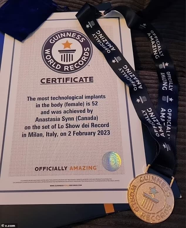 Γνωρίστε την Anastasia Synn: Είναι «το απόλυτο cyborg» με 52 εμφυτεύματα στο σώμα της, Γνωρίστε την Anastasia Synn: Είναι «το απόλυτο cyborg» με 52 εμφυτεύματα στο σώμα της, TechWar.gr