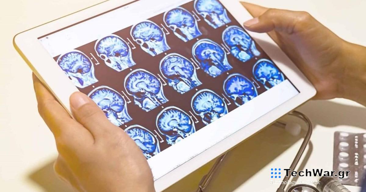 Ερευνητές ανέπτυξαν νέο φάρμακο που δίνει ελπίδες στους ασθενείς με πολλαπλή σκλήρυνση