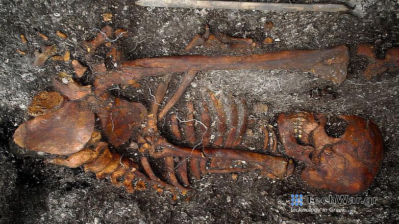 Βραζιλία: Ανακαλύφθηκε DNA συγγενικού βακτηρίου της σύφιλης σε σκελετούς ηλικίας 2.000 ετών