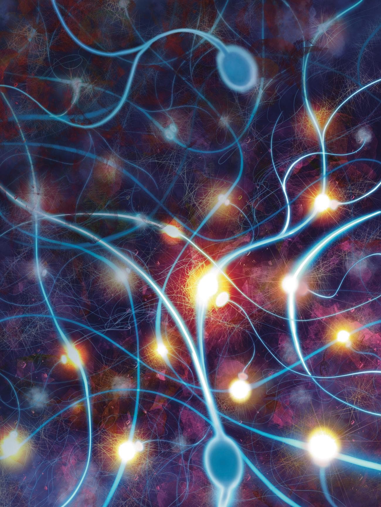 Αλτσχάιμερ