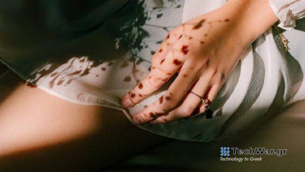 Πώς το σύνδρομο πολυκυστικών ωοθηκών επηρεάζει την ψυχική υγεία των γυναικών