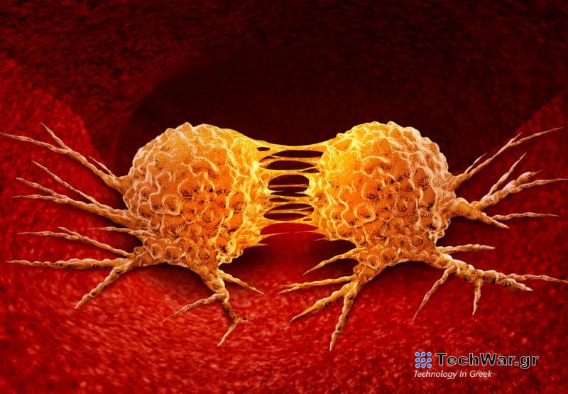 Πάνω από 75% η αύξηση των καρκίνων έως το 2050