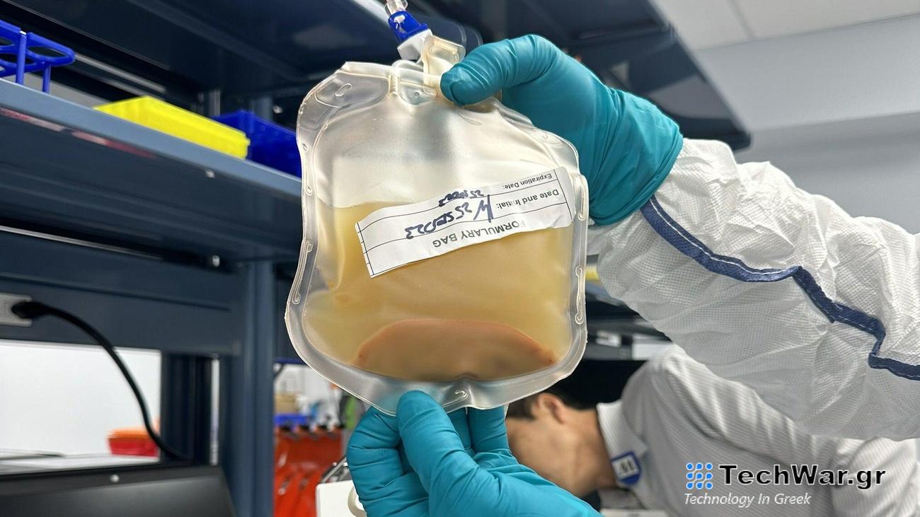an yellow-ish bag of liver cells in a suspension.