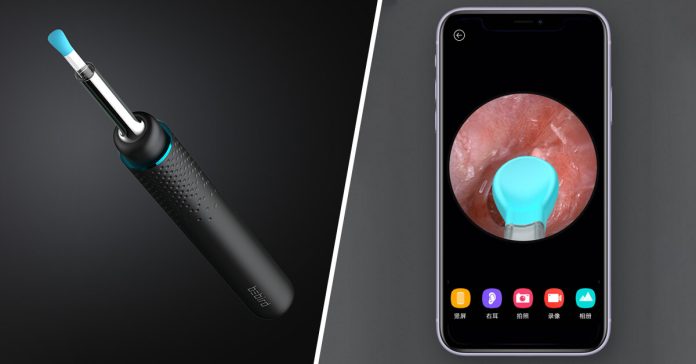 [Teraz kupón] Αυτό το gadget θα σας εκπλήξει: το έξυπνο καθαριστικό αυτιών από το οικοσύστημα Xiaomi περιέχει μια κάμερα και έχει τη δική του εφαρμογή
